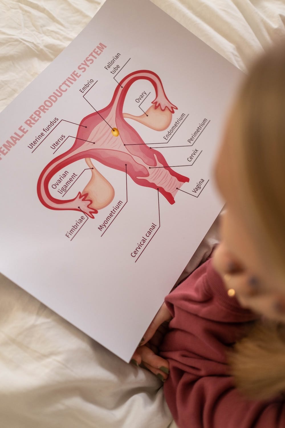 Endometriose: Symptome, Diagnose und Behandlung - KORA MIKINO