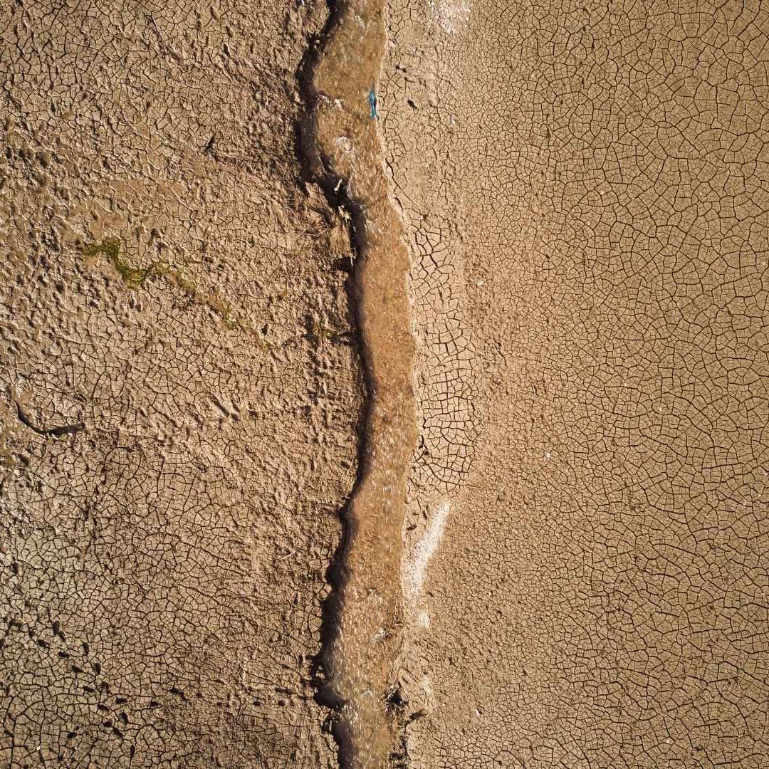 Scheidentrockenheit - was dagegen hilft!